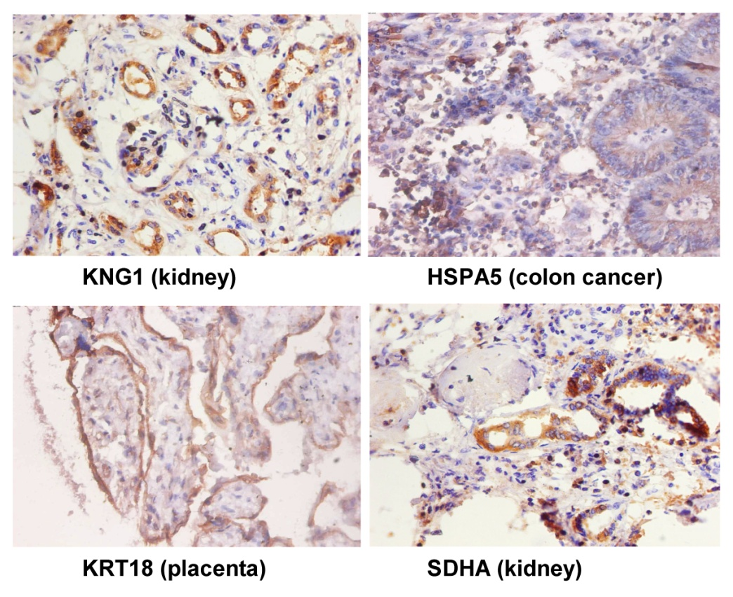 ki67免疫组化图片